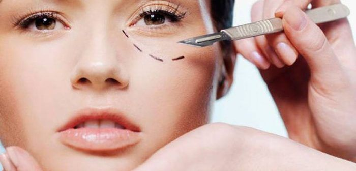 Phau Thuat Tham My Vung Mat Cat Mi Lay Mo Tao Hinh Mi Mat – Benh Vien Tham My HATY 4